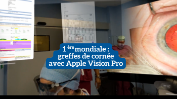 Première mondiale : un chirurgien de l’Hôpital Fondation  Adolphe de Rothschild réalise des greffes de cornée avec  Apple Vision Pro